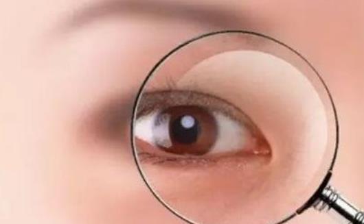 敷眼是熱敷好還是冷敷好?熬夜引起的眼睛疲勞怎么緩解?