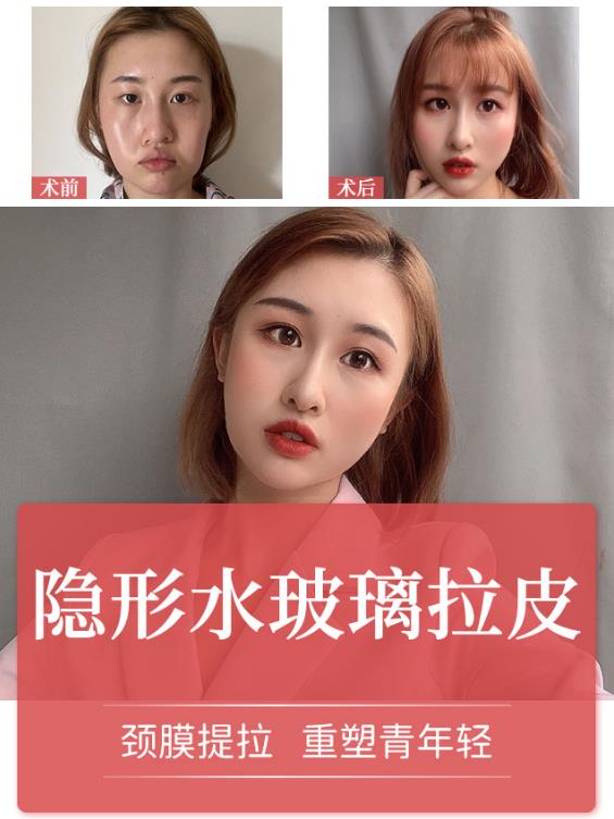 常州曙光整形醫(yī)院李智明主任好嗎 非手術(shù)治療,實(shí)現(xiàn)面部年輕化