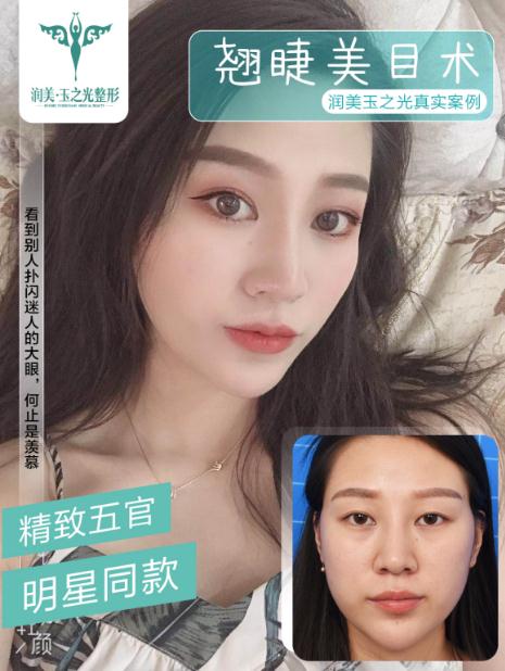 成都潤美玉之光羅通貴:豐富的手術(shù)經(jīng)驗(yàn)和高標(biāo)準(zhǔn)的審美理念