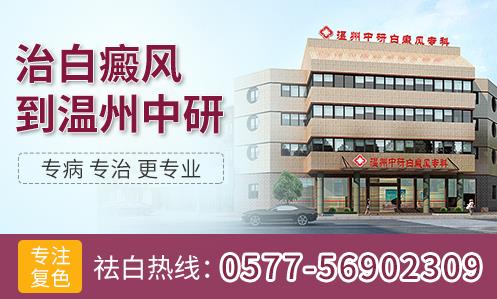 溫州中研白癜風(fēng)?疲焊共可系陌遵帮L(fēng)該怎么診治?