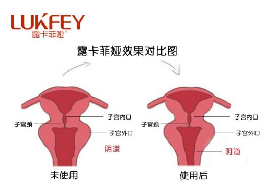 露卡菲婭藥店有賣嗎?露卡菲婭官方購(gòu)買途徑!