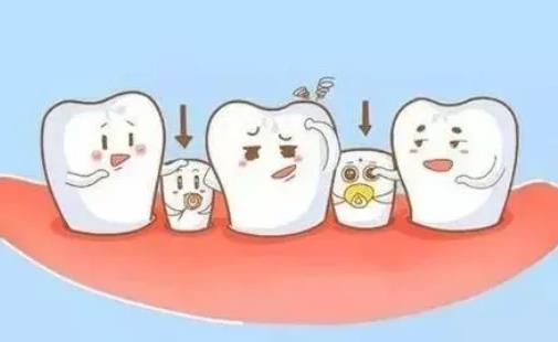 牙齒松動需要拔掉嗎?牙齒松動需要注意什么?