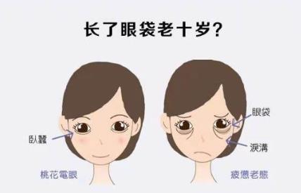 京典麗園去眼袋怎么樣 達(dá)到分型改善不開刀去眼袋