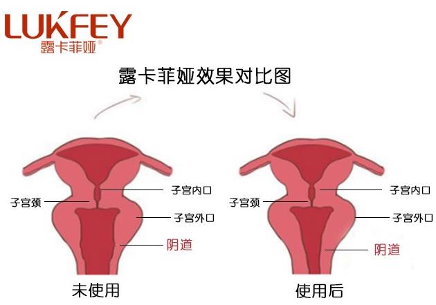 露卡菲婭藥店有賣嗎?露卡菲婭官方購(gòu)買途徑!