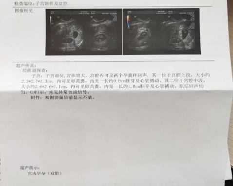 治療不孕不育哪家好?都市王桂榮主任助6年不孕女子喜得雙胎!