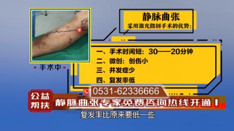 濟(jì)南中醫(yī)靜脈曲張醫(yī)院看病靠譜嗎 悉心呵護(hù)生命綻放