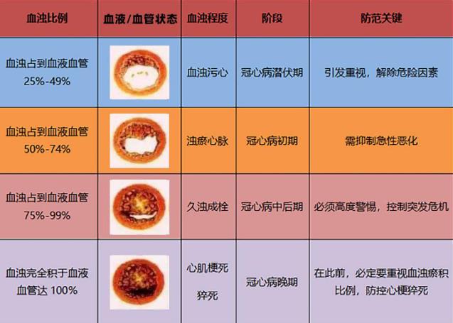 血濁有增無減 冠心病支架和搭橋后仍存生命隱患