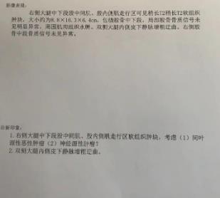 印度帕唑帕尼效果怎么樣?帕唑帕尼治療案例讓你更為了解