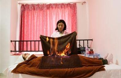 什么時(shí)候火療最好?火療要注意什么?