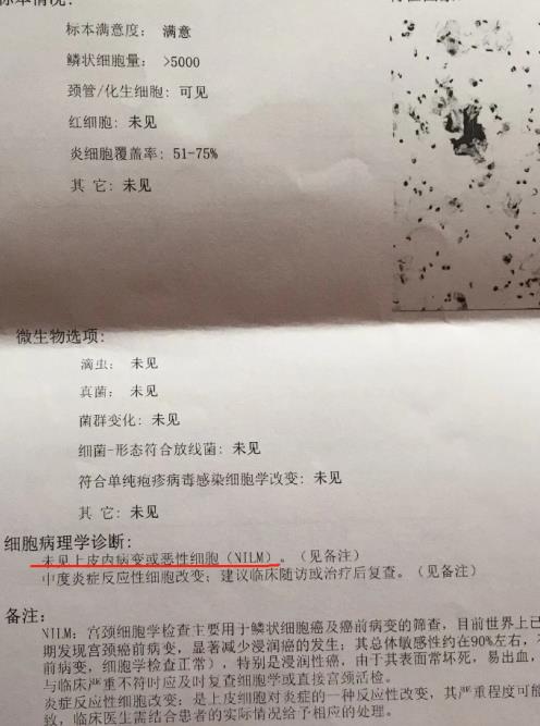 3個高危1個低危HPV感染,轉(zhuǎn)陰經(jīng)歷分享給大家