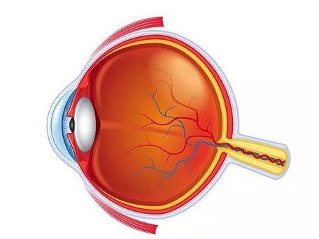 黃斑裂孔的癥狀是什么?能治好嗎?上海眼科醫(yī)生為您解析