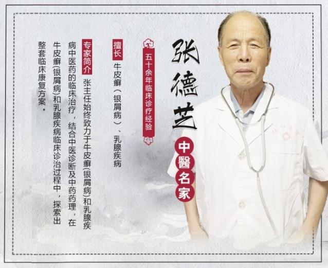 中醫(yī)張德芝:為什么會患上牛皮癬,牛皮癬原因