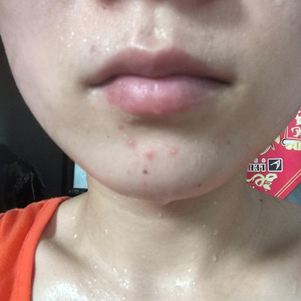 敏感肌用了都夸上天的水乳在這里!
