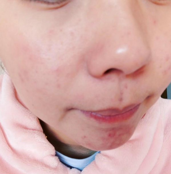 敏感肌用了都夸上天的水乳在這里!
