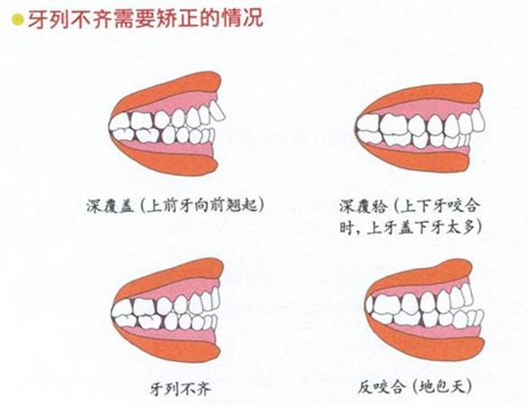 長沙德韓口腔牙齒矯正費(fèi)用貴不貴?