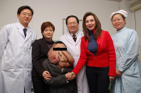 廣州腫瘤專(zhuān)家,黃春才成功治療案例
