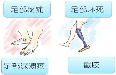 山東治療糖尿病足優(yōu)質(zhì)推薦醫(yī)院
