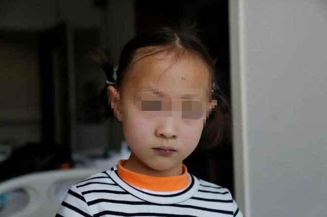 3年3次開胸,合肥京東方醫(yī)院分期手術(shù)挽救先心女童性命