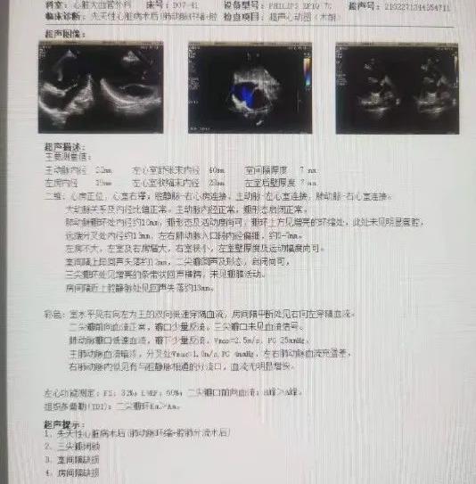 3年3次開胸,合肥京東方醫(yī)院分期手術(shù)挽救先心女童性命