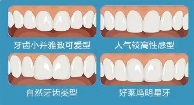 廣東省全民愛(ài)牙行動(dòng) 給大家講一下瓷貼面美學(xué)修復(fù)~