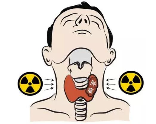 有甲狀腺結(jié)節(jié)會(huì)不會(huì)是甲狀腺癌?成都民生耳鼻喉醫(yī)院告訴你