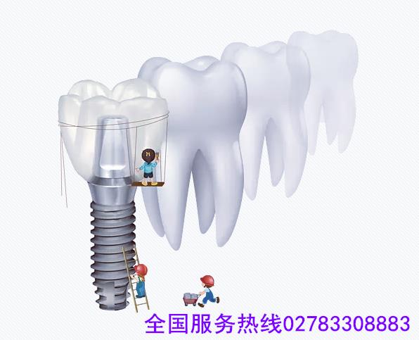 武漢德韓口腔揭秘種植牙齒外觀,種牙后會覺得假嗎?