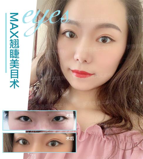 成都潤美玉之光羅通貴院長專業(yè)嗎 打造只屬于你的眼