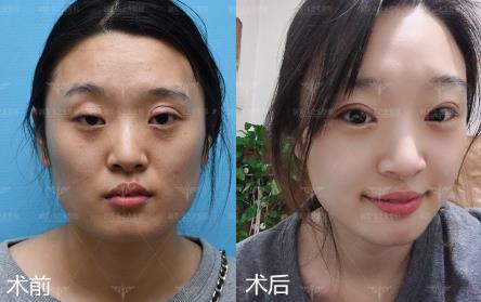 成都潤美玉之光羅通貴院長專業(yè)嗎 打造只屬于你的眼
