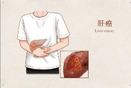 貴州盛京中醫(yī)肝病醫(yī)院看肝病技術(shù)怎么樣 為患者的健康負責(zé)