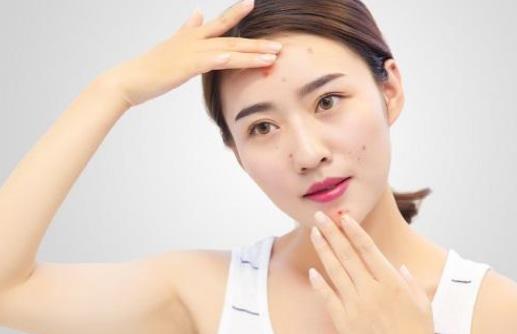 激素臉有哪些危害?激素臉和敏感肌有什么區(qū)別?