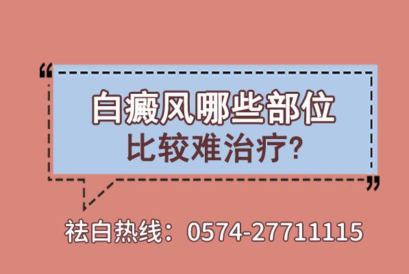 寧波華仁白癜風醫(yī)院正規(guī)嗎?白癜風哪些部位比較難治療?