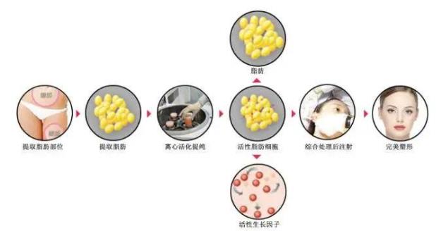 云南銅雀臺整形趙蘭明主任脂肪填充如何 專業(yè)提供整形美容服務