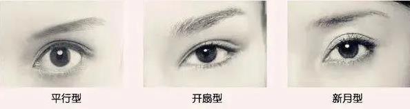 上海玫瑰整形鄒功偉醫(yī)生雙眼皮技術(shù)如何 專業(yè)整形品質(zhì)保證