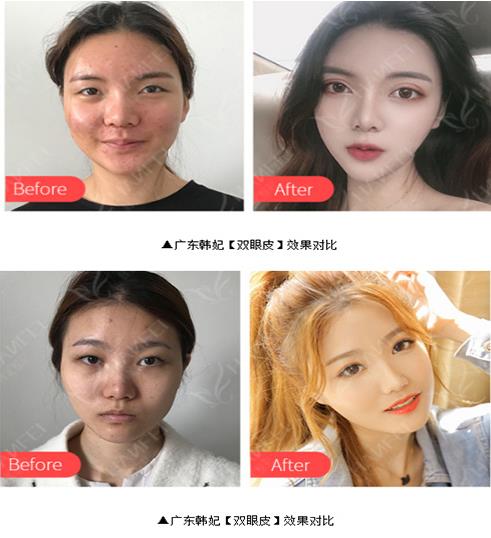 廣東韓妃于洪瑞主任怎么樣 提出“眼部生物力學(xué)理論”