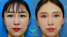 北京蘇亞醫(yī)美隋冰受邀參加全國線技術實操高峰論壇