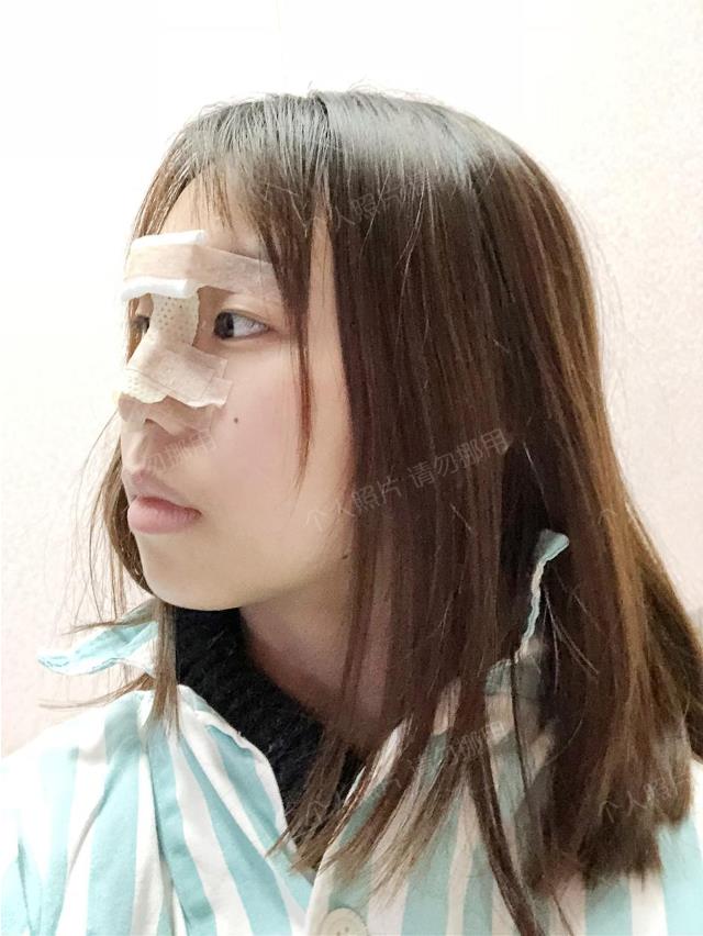 武漢楊水斌做肋軟骨鼻綜合怎么樣?好看的鼻子帶來的是時(shí)尚的氣質(zhì)!