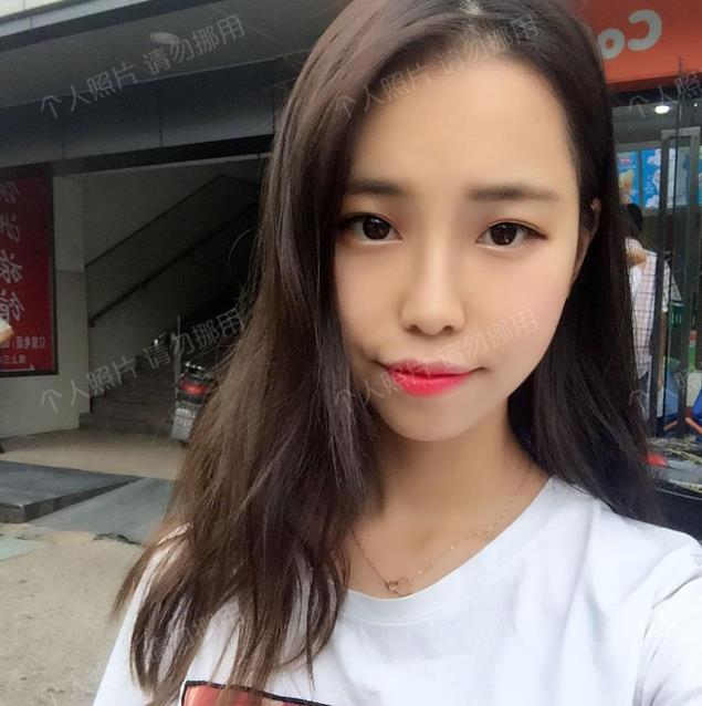 武漢楊水斌做肋軟骨鼻綜合怎么樣?好看的鼻子帶來的是時(shí)尚的氣質(zhì)!