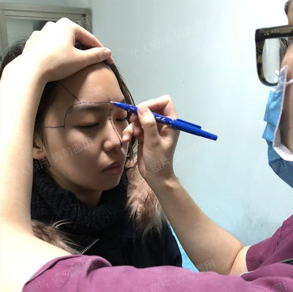武漢楊水斌做肋軟骨鼻綜合怎么樣?好看的鼻子帶來的是時(shí)尚的氣質(zhì)!
