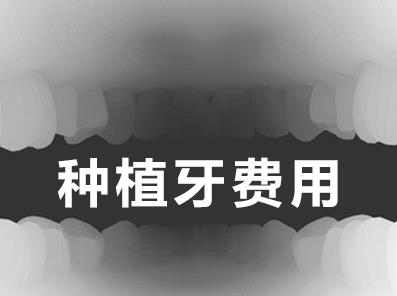 天津瑞典nobel種植牙多少錢一顆,中諾口腔真心實意為民