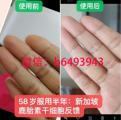 新加坡小紅丸營鹿胎素多少錢一盒,代理價格表