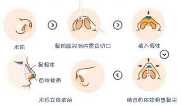 泉州歐菲整形醫(yī)院做雙眼皮好不好?安全塑美 個(gè)性定制