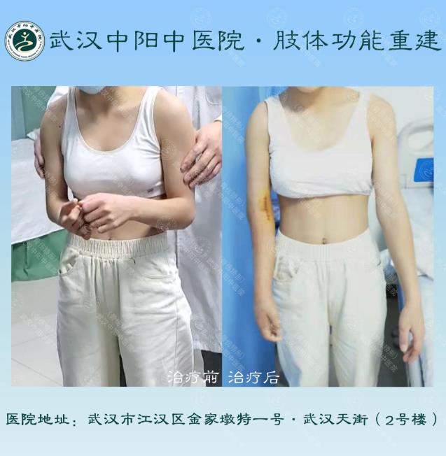 武漢中陽(yáng)矯形·骨科矯形技術(shù)丨3-14歲小兒骨科矯形圖集