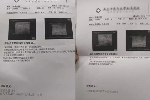 福乳堂金賢中醫(yī)好不好 乳腺增生怎么治好?
