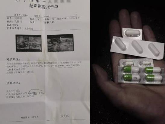 福乳堂金賢中醫(yī)好不好 乳腺增生怎么治好?