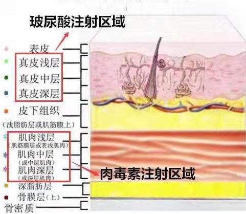 怕痛怕動(dòng)刀?王的整形楊汝教你午休一刻搞定微整形