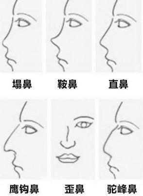 云南銅雀臺(tái)整形醫(yī)院左萬昌主任 面診隆鼻前該了解的干貨
