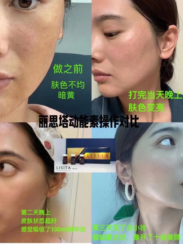 麗絲塔小金盒高級抗衰水光動能素