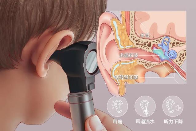 成都民生耳鼻喉醫(yī)院提醒:除了小心中耳炎,更要警惕中耳癌!