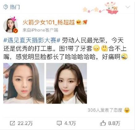 牙不齊顏值受影響?青島優(yōu)諾·博士牙齒美學矯正