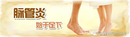 泉州成功醫(yī)院看脈管炎好嗎 脈管炎中醫(yī)辨證食療